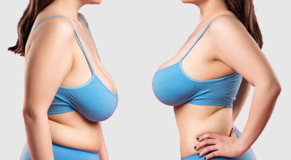 achieving-you-ideal-body