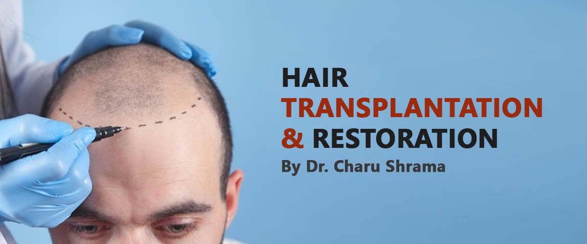 hair-transplant-in-delhi