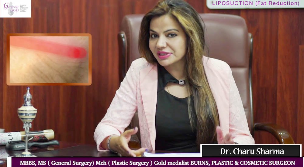 cosmetic-surgery-video